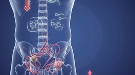 정계정맥류, 남성의 삶의 질을 가르는 질환